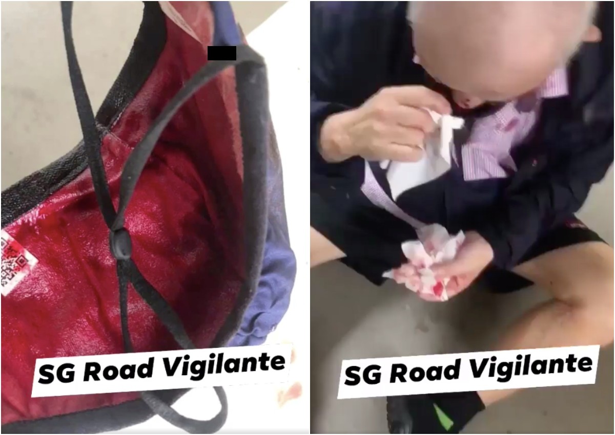 No foul play: Elderly man with bloody nose at Whampoa was not knocked down by e-scooter, say police