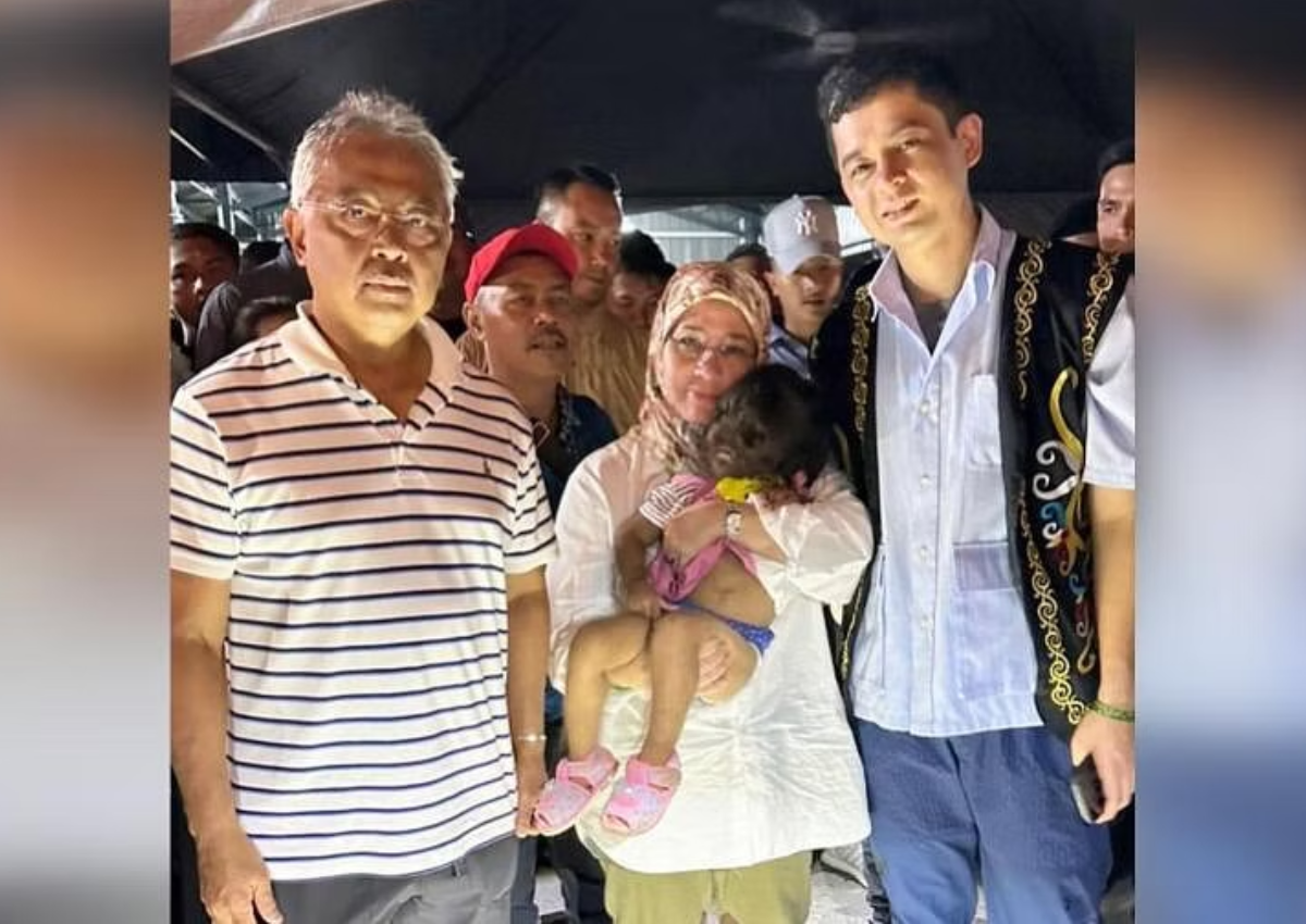 Toddler with excessive facial hair, no nostrils catches Malaysian King and Queen's attention